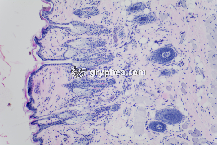 Peau avec glandes sébacées x100 - gryphea.org